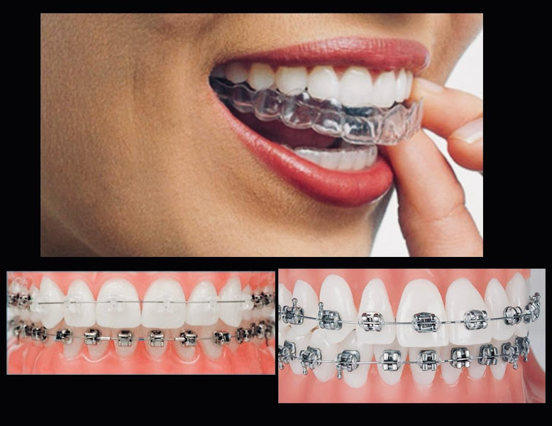 Foto 3 de L&V - Odontologia Especializada