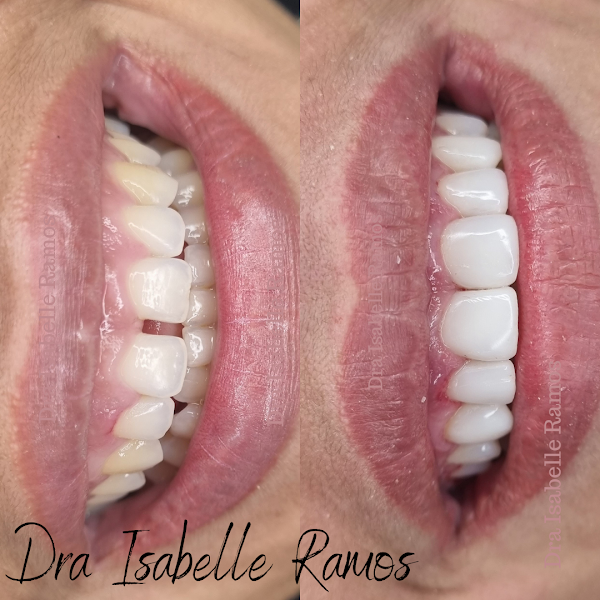 Foto 3 de La Belle Odontologia Especializada