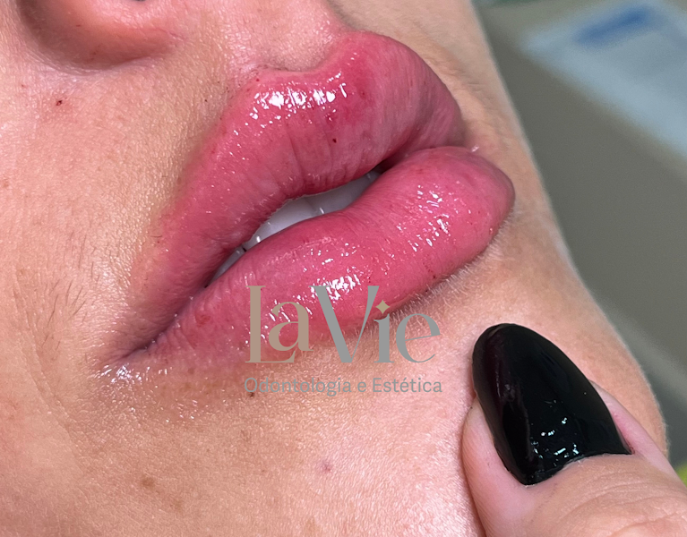 Foto 3 de La Vie Odontologia e Estética