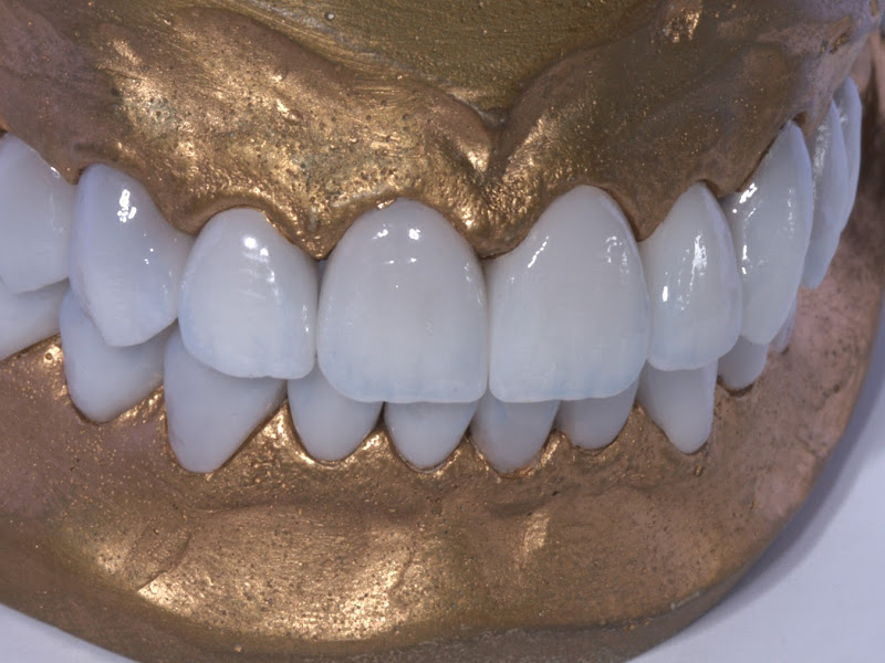 Foto 2 de Lab Up - Ateliê Dental