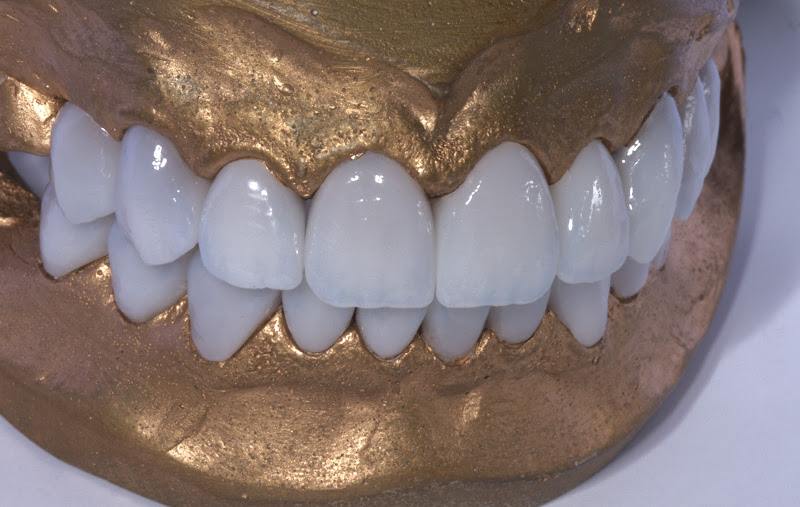 Foto 3 de Lab Up - Ateliê Dental