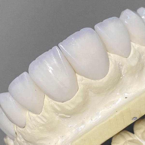 Foto 2 de LabClass | Laboratório de Próteses Dentárias | Lentes de porcelana | Guarulho