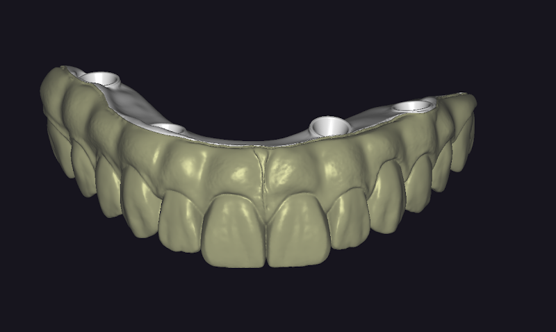 Foto 2 de Laboratorio AJY proteses