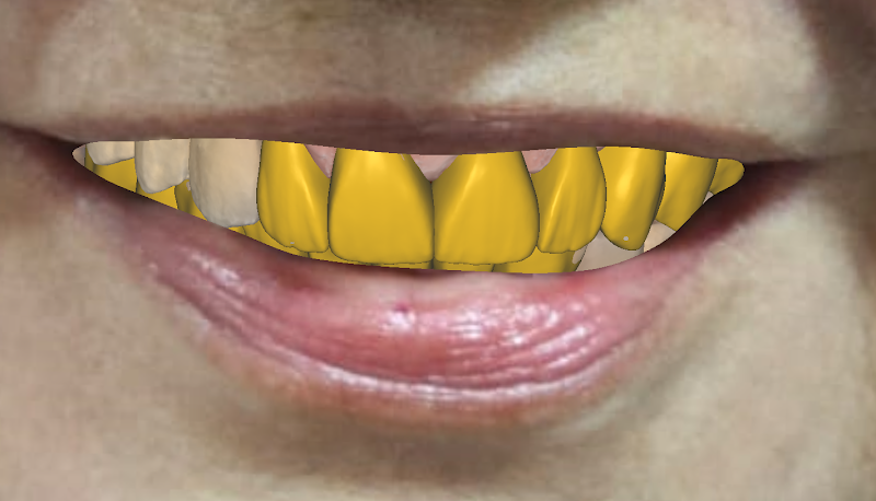 Foto 3 de Laboratorio AJY proteses