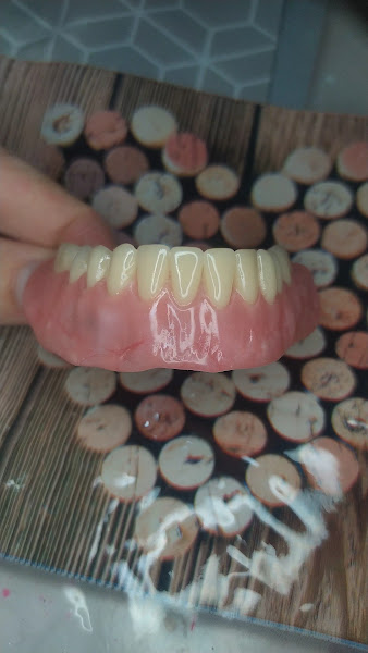 Foto 3 de Laboratório D'Paula - prótese dentaria e orto