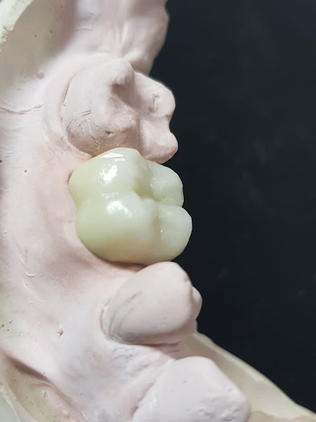 Foto 2 de Laboratorio de protese dentaria