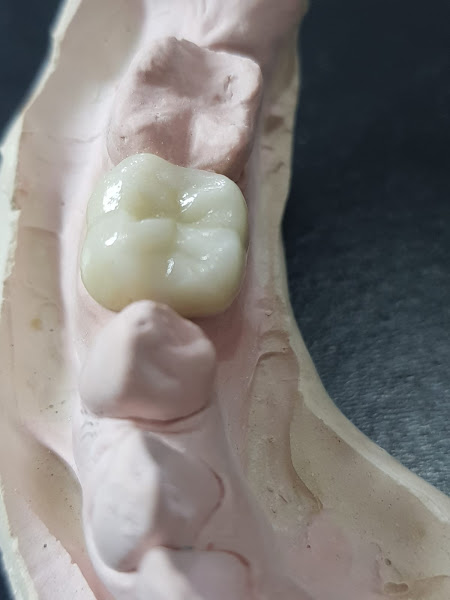 Foto 3 de Laboratorio de protese dentaria