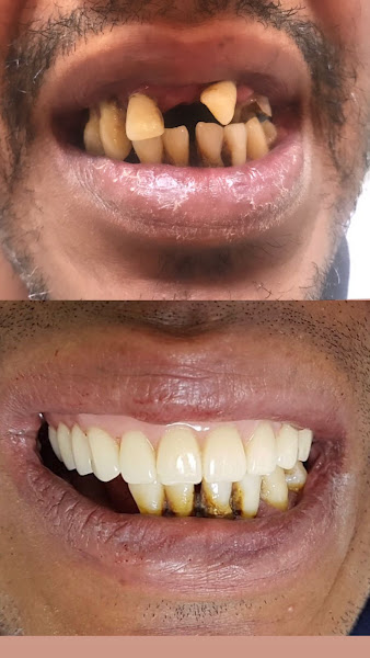 Foto 3 de Laboratório de Prótese Dentária Arcadas São Carlos (Protética Roseli - CRO 4488)