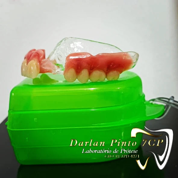 Foto 3 de Laboratório de Prótese Dentária Darlan Pinto 7CP