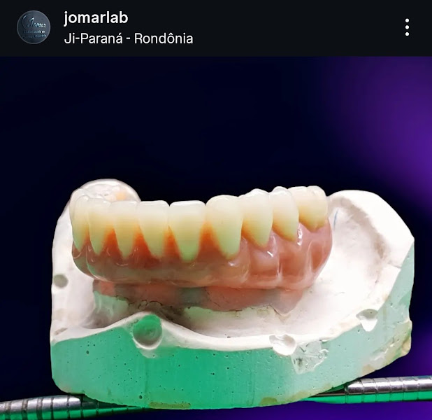 Foto de Laboratório de Prótese Dentária JoMar