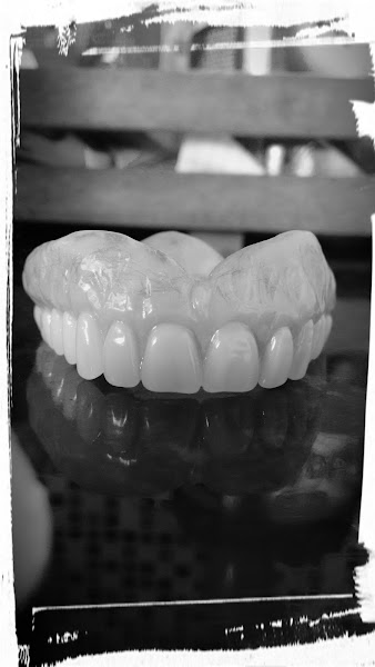 Foto 2 de Laboratório de Prótese Dentária JoMar