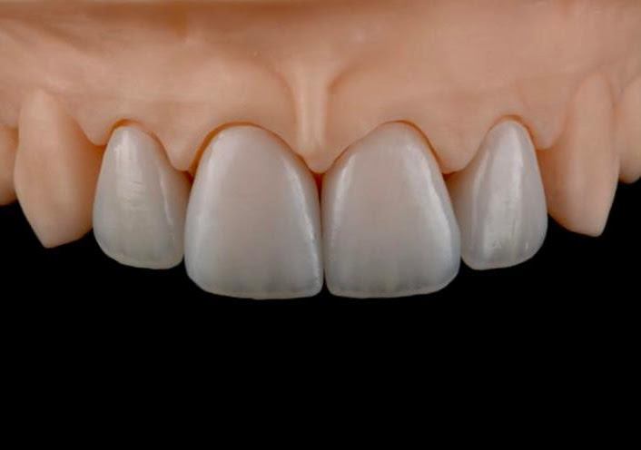 Foto 2 de Laboratório de Prótese Dentária Keramos LTDA