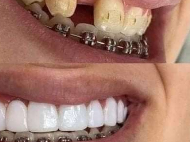 Foto 2 de Laboratório de Prótese Dentaria Lc