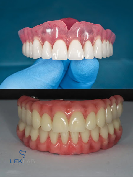 Foto 3 de Laboratório de Prótese Dentária LEKLAB