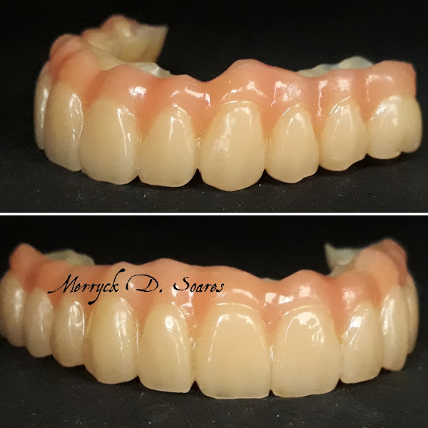 Foto 2 de Laboratório de Prótese Dentária MDS