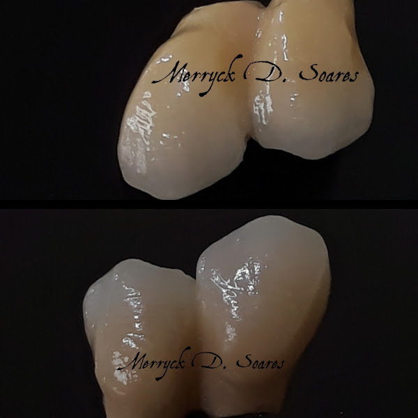 Foto 3 de Laboratório de Prótese Dentária MDS