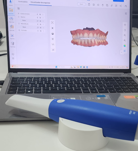 Foto 2 de Laboratorio de protese dentaria Risus design dental