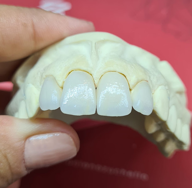 Foto 3 de Laboratorio de protese dentaria Risus design dental