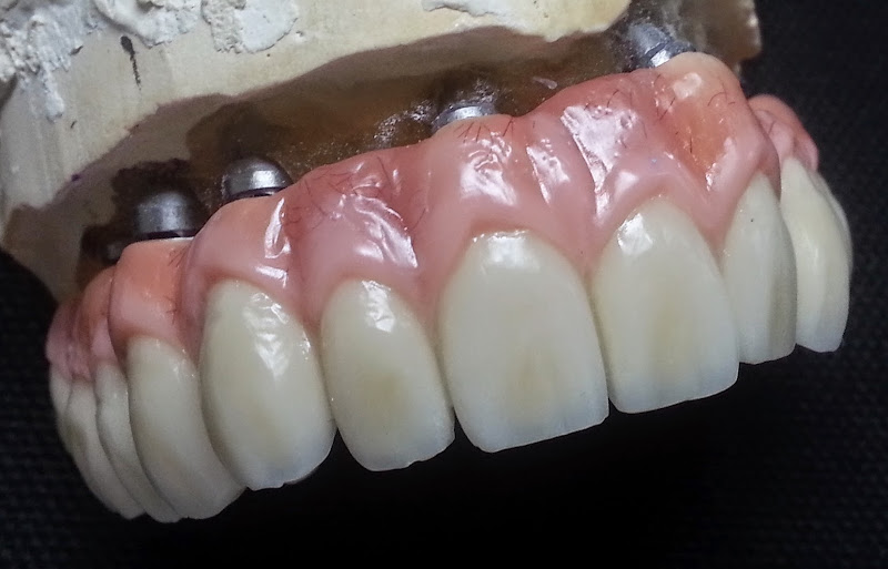 Foto 2 de Laboratório de Prótese Dentária Rogério Pazinato