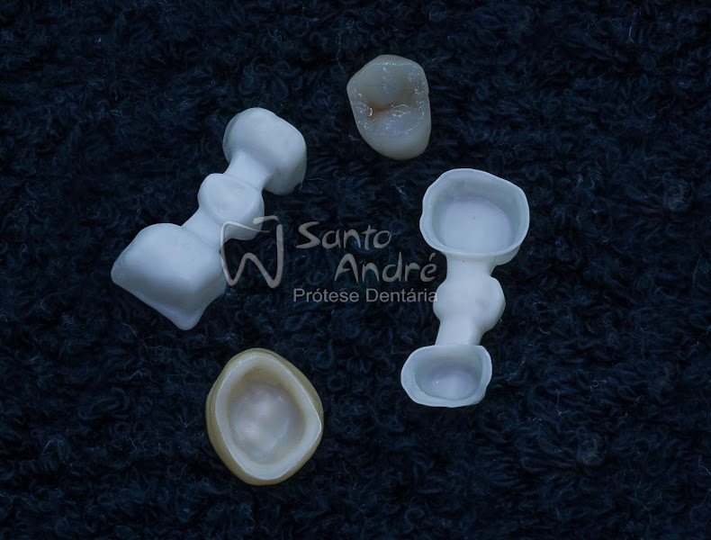 Foto 3 de Laboratório de Prótese Dentária Santo André