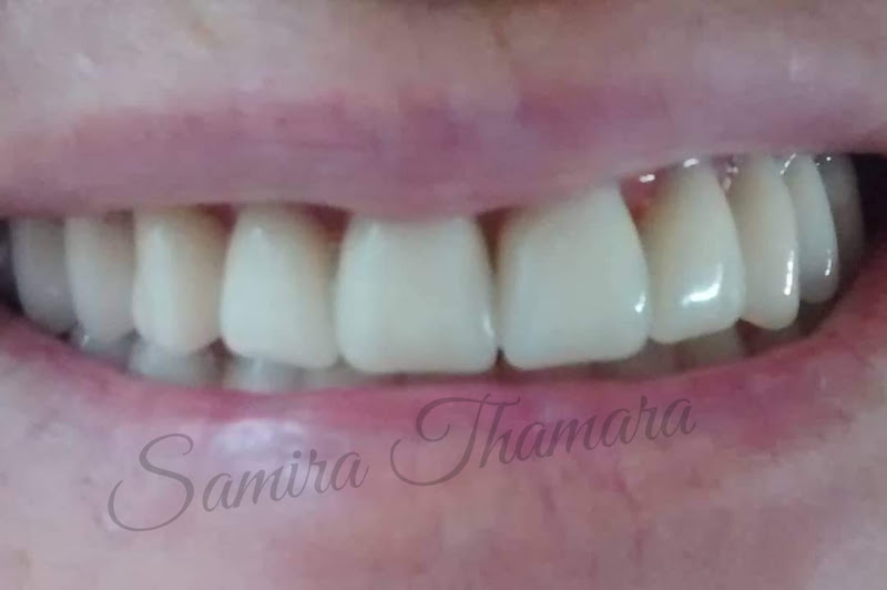 Foto 3 de Laboratório de Prótese Dentária ST