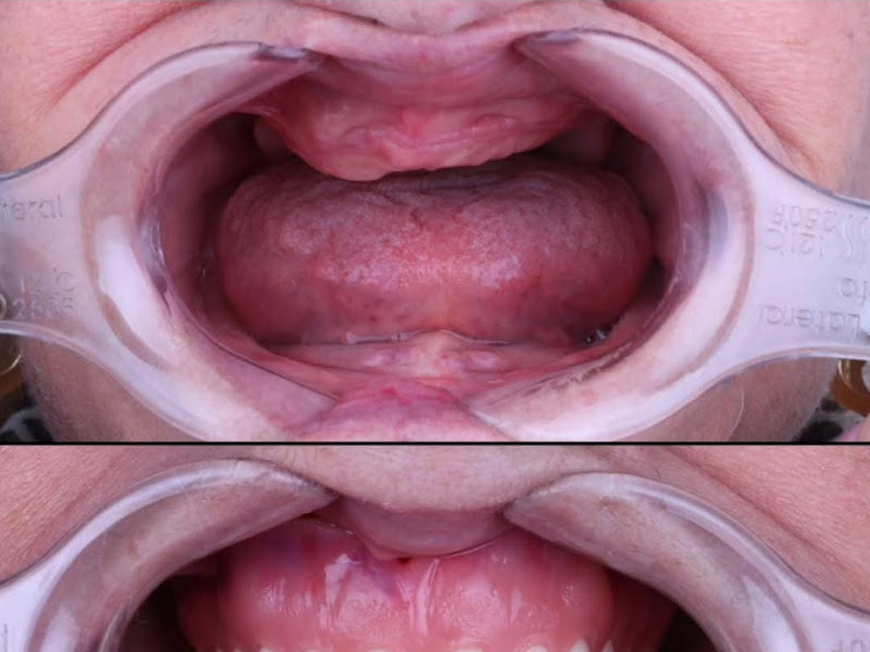 Foto 3 de Laboratório de Prótese Dentária Tachotte