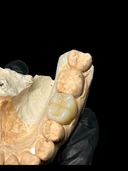 Foto 2 de Laboratorio de Protese Menescal