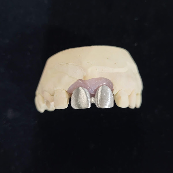 Foto 2 de Laboratório de Prótese Odontológica Keramos LTDA.