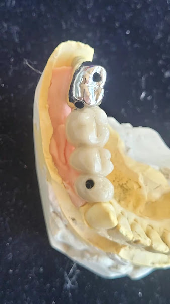 Foto 3 de Laboratório de Prótese Odontológica Keramos LTDA.