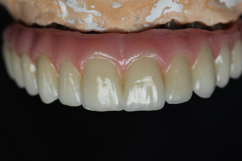 Foto 3 de Laboratório de Prótese Odontológica Silgitz Ltda