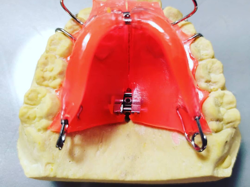 Foto de Laboratório de prótese OverDent