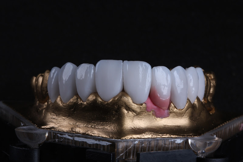 Foto 2 de Laboratório de Prótese | Vip Estética Dental