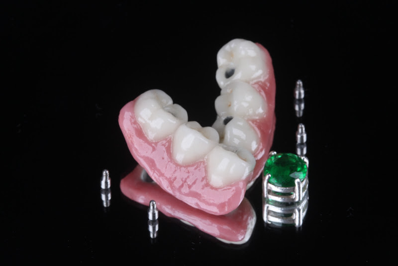 Foto 3 de Laboratório de Prótese | Vip Estética Dental