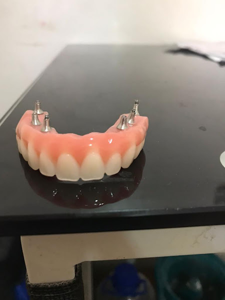 Foto 3 de Laboratório de Próteses Dentárias Vicente JR