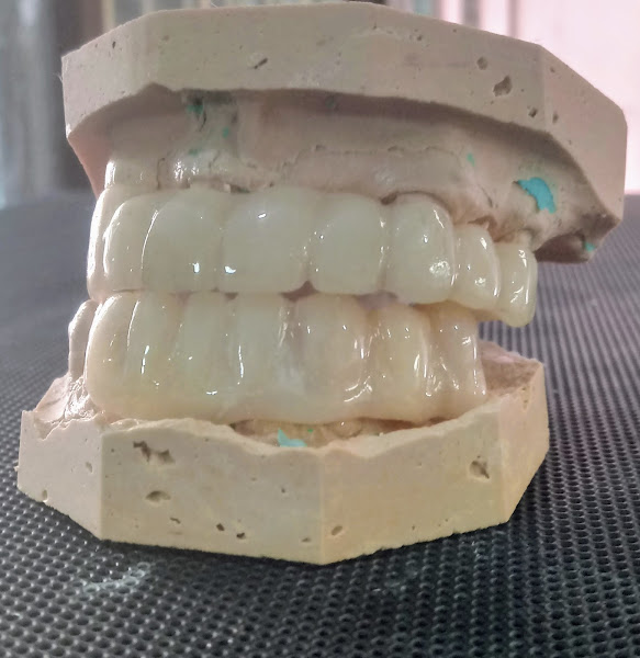 Foto 2 de Laboratorio Dente de Leão/ Atendimento para Cirurgião Dentistas