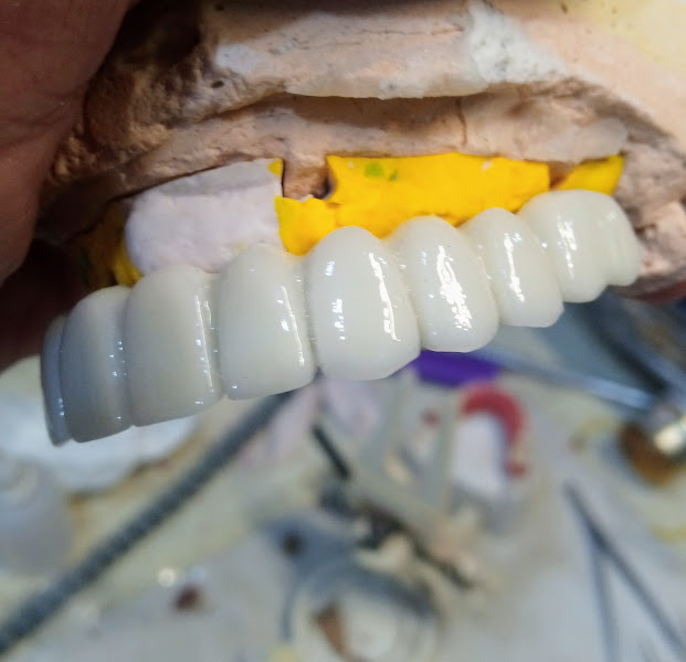 Foto 3 de Laboratorio Dente de Leão/ Atendimento para Cirurgião Dentistas