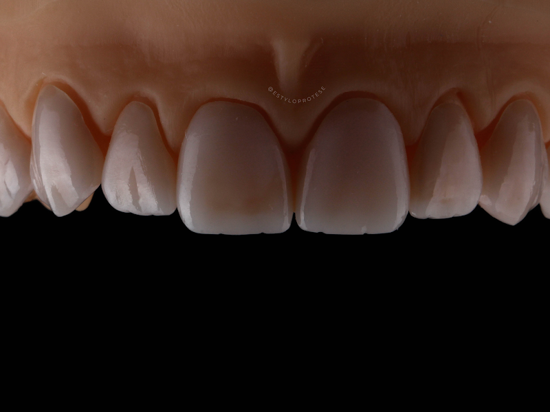 Foto 3 de Laboratório Estylo Prótese Dentária LTDA- Laboratório de Prótese Dentária em São Luís, MA-BRA