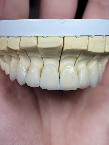 Foto 3 de Laboratório Fiori Prótese Dentária