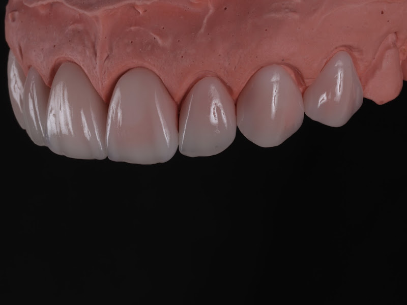 Foto 2 de Laboratório Lacerda prótese dentária