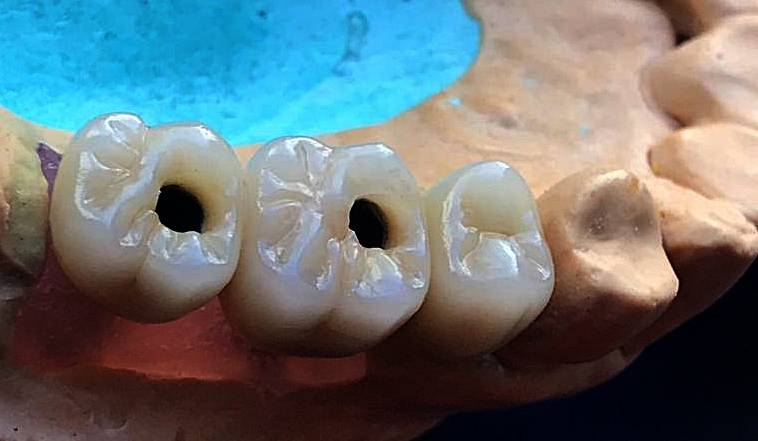 Foto 3 de Laboratório Nuno Prótese Dentária