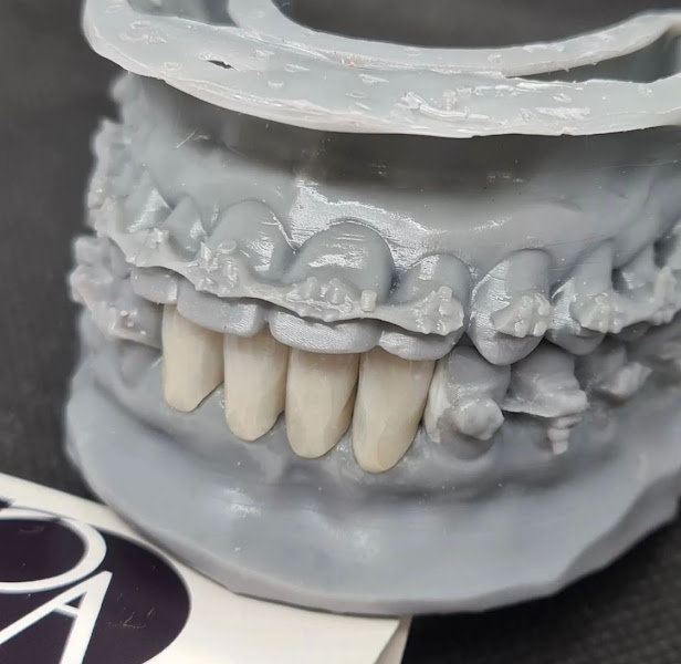 Foto 3 de Laboratório Protese Art | Laboratório de Prótese Dentária em Santo André