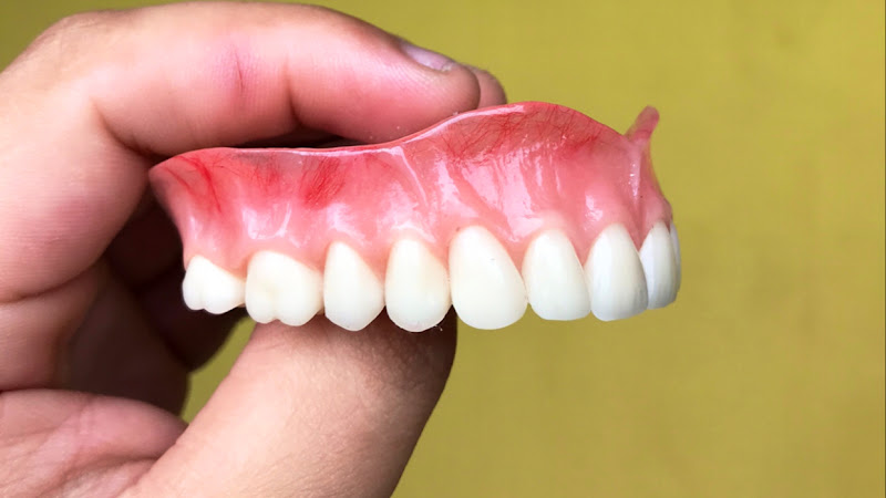 Foto 2 de Laboratório prótese dentária & Orto - CPD