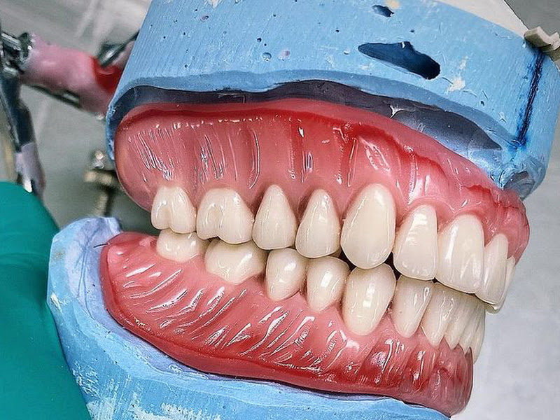 Foto 7 de Laboratório prótese dentária & Orto - CPD