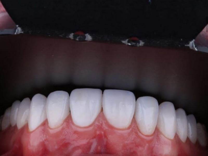 Foto 2 de Laborzil Prótese Dentária