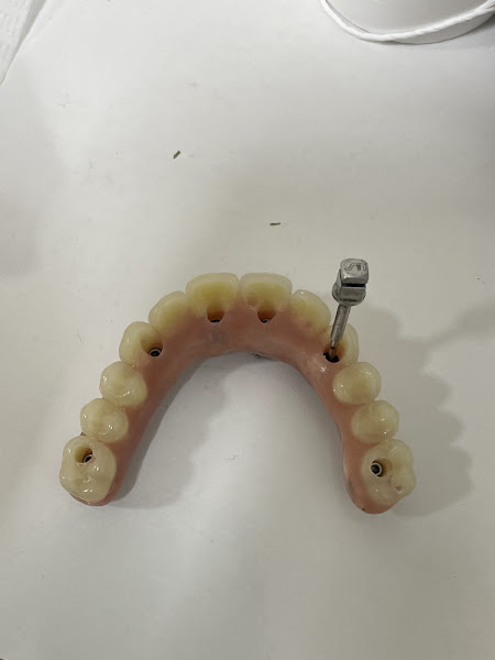 Foto 3 de Lagos Dente implante dentário Macae