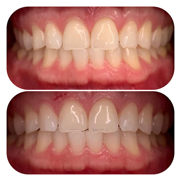 Foto 2 de Landmann Odontologia e Harmonização Facial