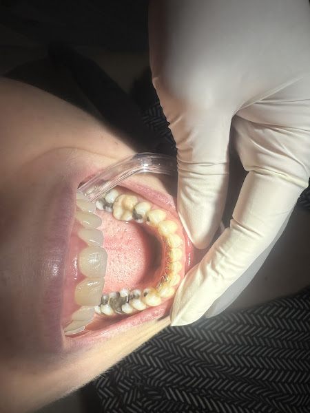 Foto 3 de Lapidare Odontologia e Estética