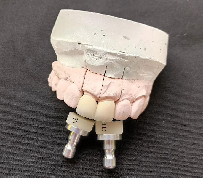 Foto 2 de Laproodonto | Laboratório de Prótese Dentária