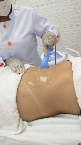 Foto 3 de Laranja Bronze e Estética