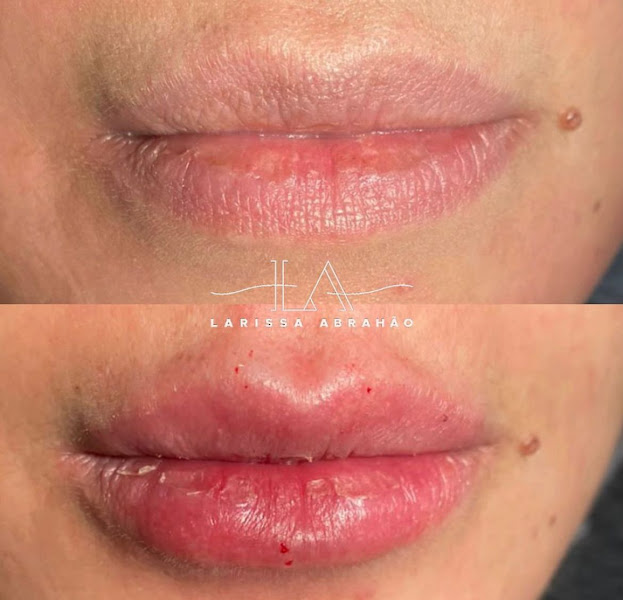 Foto 2 de Larissa Abrahão Odontologia